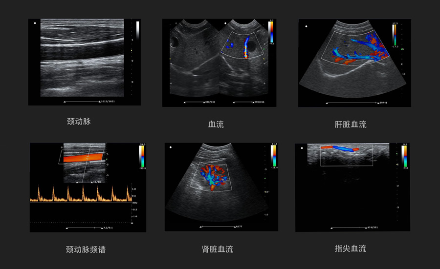 医用KR-S60标准版-80阵元-两接口彩超机