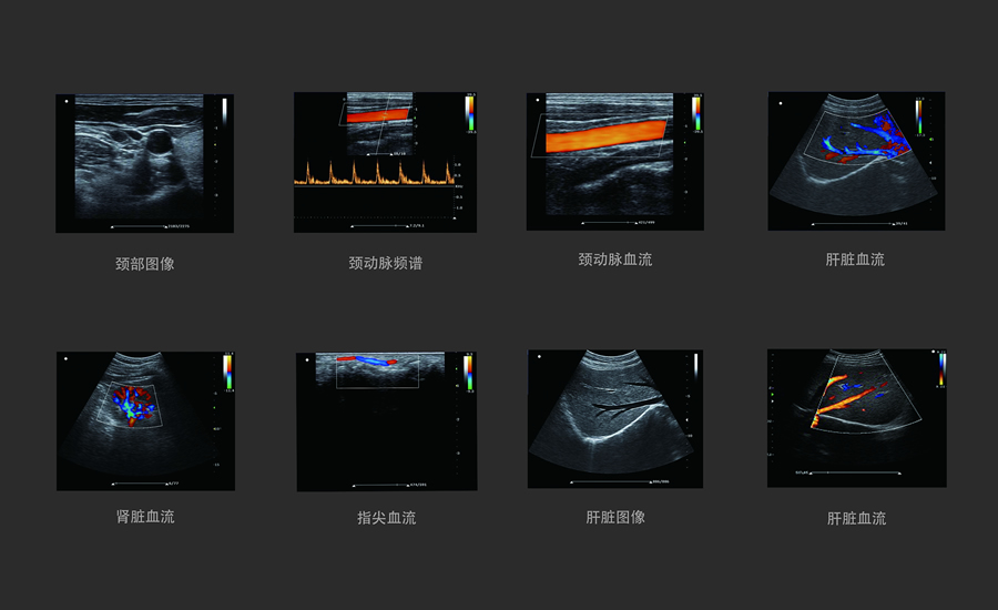 医用KR-S80增强版-四接口彩超机