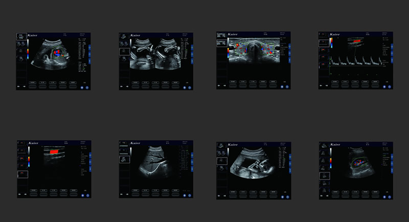兽用S70pro三接口推车式宠物彩超机