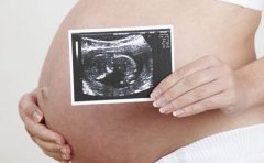 B超检查在怀孕初期多久做一次对宝妈宝宝无害
