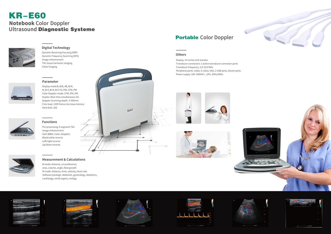 KR-E60笔记本彩超机