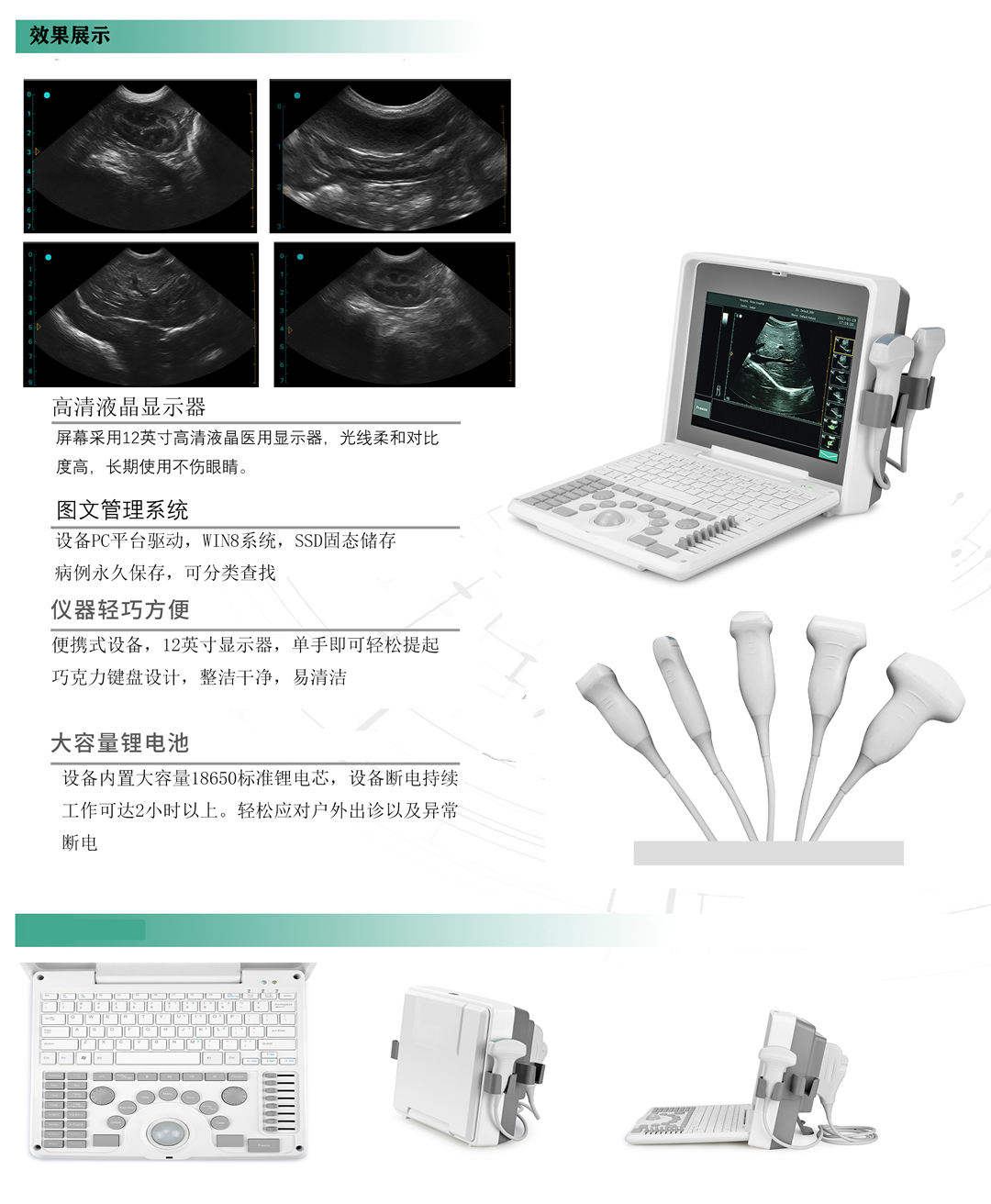 KR-1088Z全数字便携式B超